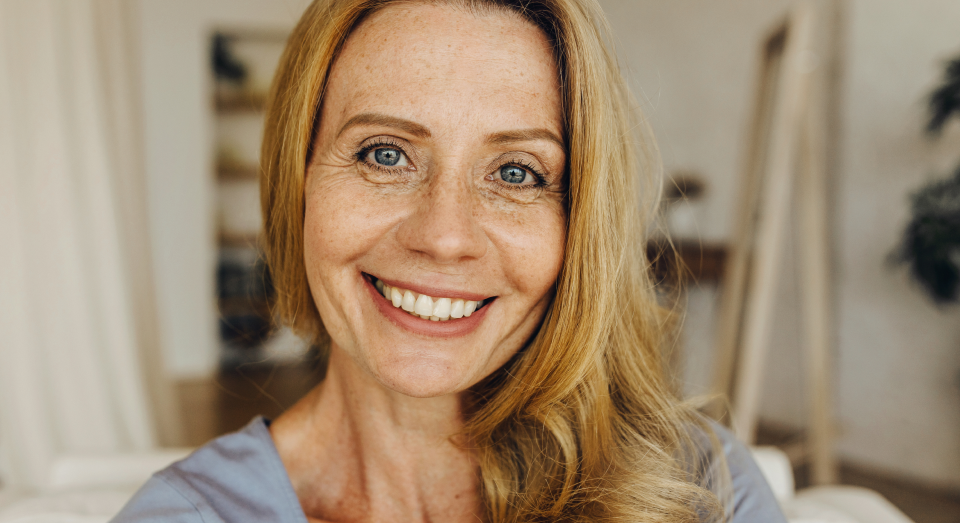 Face Lift Model Smile